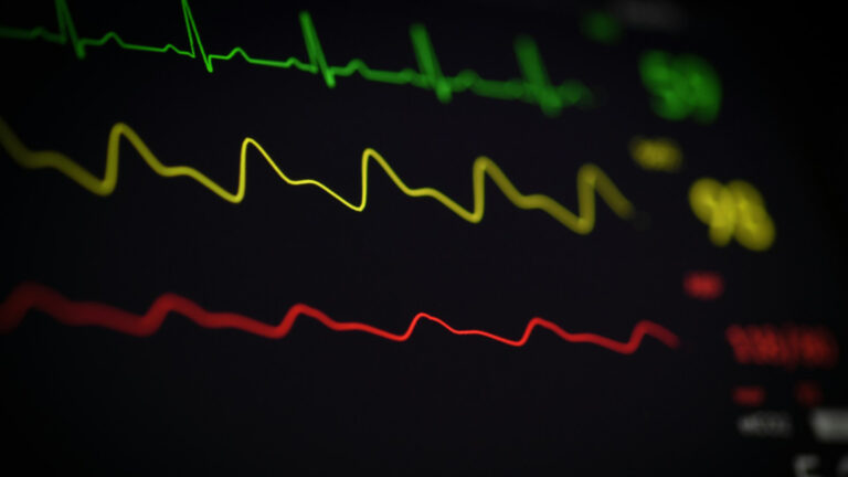 News Article: AI Meets Heart Health