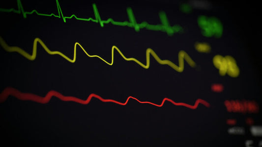 News Article: AI Meets Heart Health
