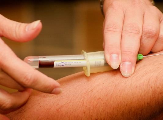 Blog: Cholesterol — What You Need to Know